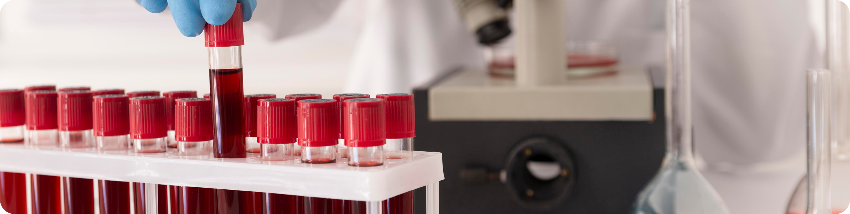 Toma de muestra de sangre en laboratorio